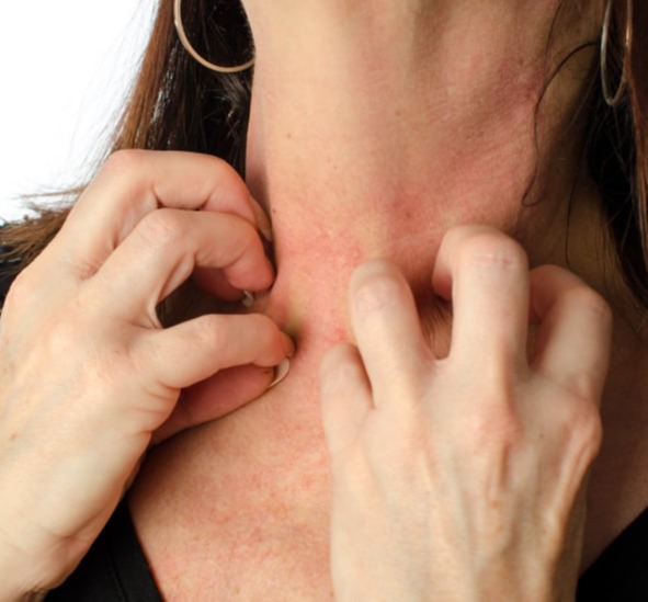 Dupixent (Dupilumab)