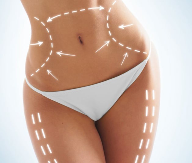 Λιποαναρρόφηση - Λιπογλυπτική