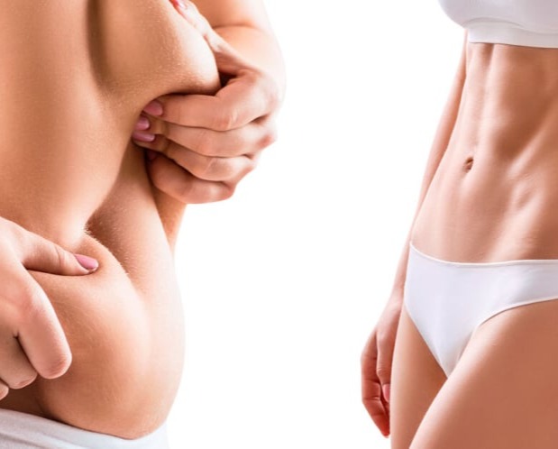 Λιποέγχυση - Λιπομεταφόρα