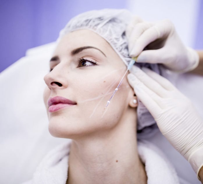 Νήματα - Thread Lift