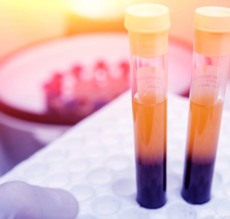 Αυτόλογες Θεραπείες