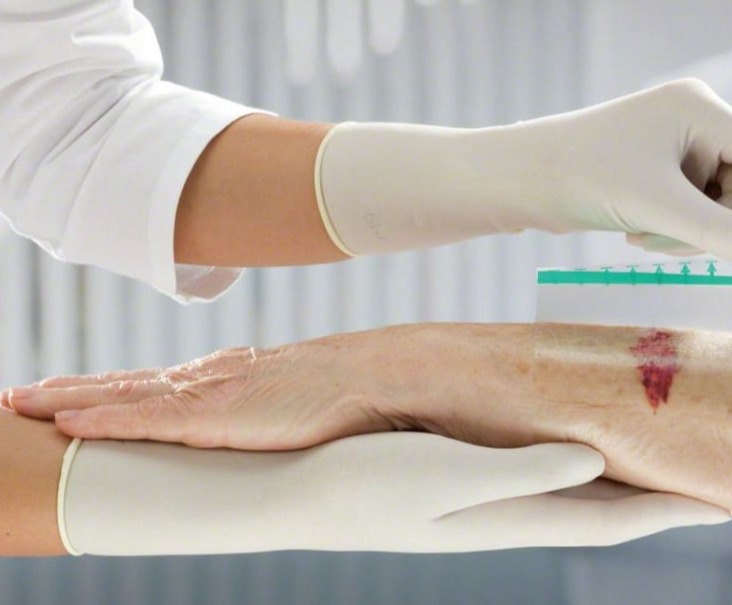 Αποκατάσταση τραυμάτων