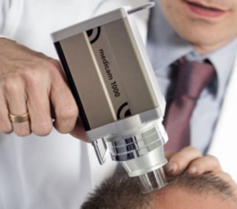 Τριχοριζόγραμμα